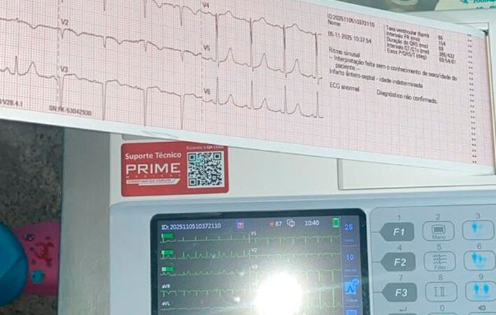 Prefeitura de Baixa Grande adquire ECG portátil e fortalece o cuidado com a saúde cardíaca da população