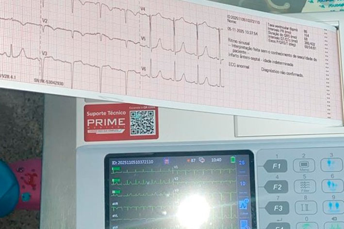 Prefeitura de Baixa Grande adquire ECG portátil e fortalece o cuidado com a saúde cardíaca da população