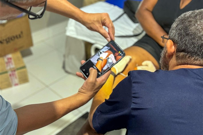 Prefeitura de Baixa Grande realiza segunda aplicação do tratamento de esclerose com espuma