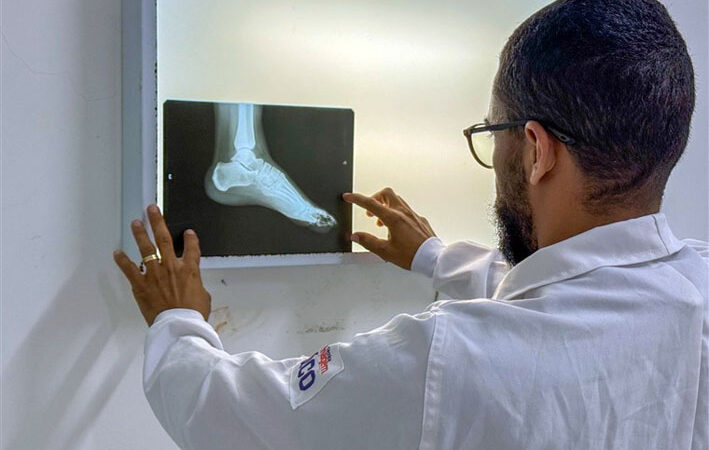 Raio-X volta a funcionar no Hospital de Baixa Grande após quase 4 anos parado