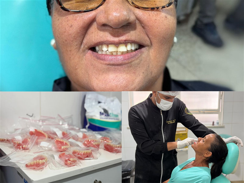 Nova remessa de próteses dentárias beneficia cerca de 50 pessoas em Baixa Grande
